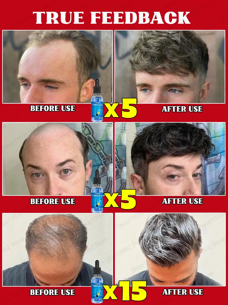Hair Growth & Anti-Loss