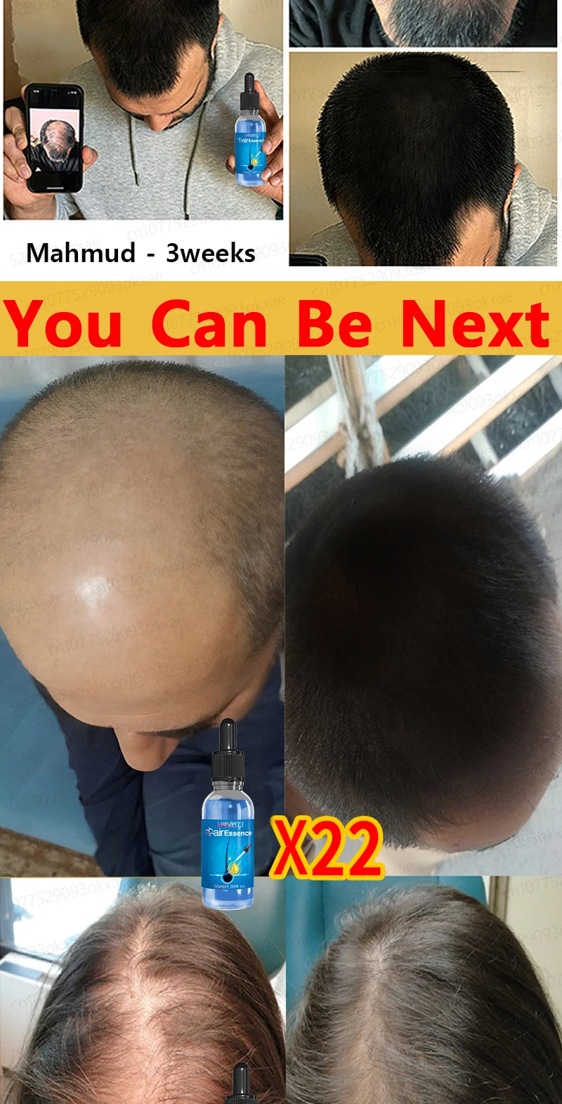 Hair Growth & Anti-Loss