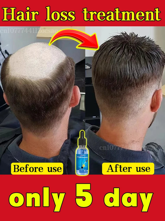 Hair Growth & Anti-Loss